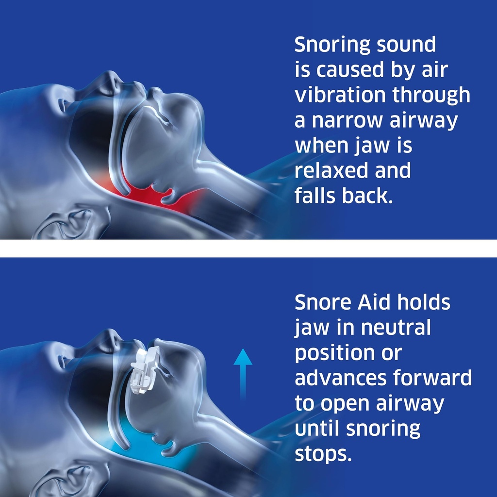sleepright-snore-aid-plus-nasal-breathe--3.jpg