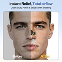 nose-strips-for-breathing-snoring-extra--4.jpg