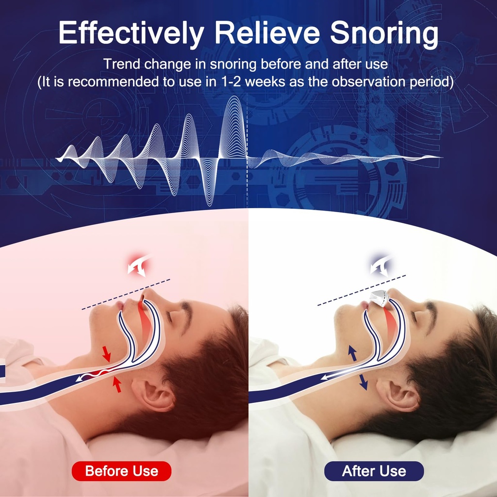 electric-anti-snoring-devices-stop-snori-4.jpg