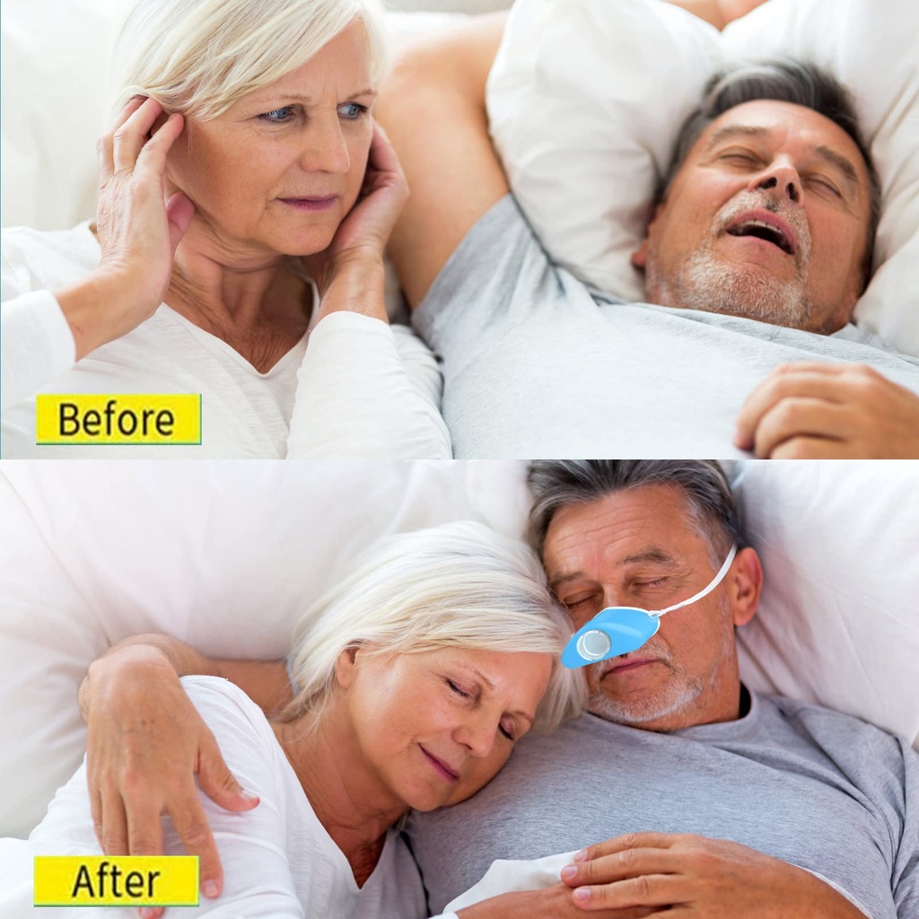 4-in-1-anti-snoring-device-with-gentle-m-4.jpg