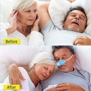4-in-1-anti-snoring-device-with-gentle-m-4.jpg