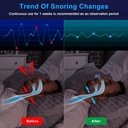 reusable-anti-snoring-device-mini-sleepa-3.jpg