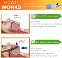 2025-model-anti-snoring-chin-strap-stop--4.jpg