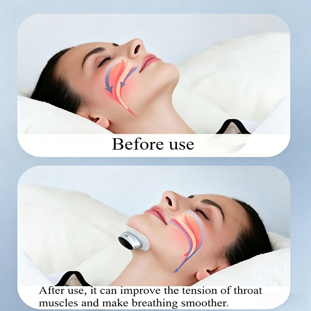 sleepease-pro-2-0-2026-upgraded-z3-pro-a-6.jpg