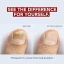 kerasal-nail-renewal-restores-appearance-4.jpg