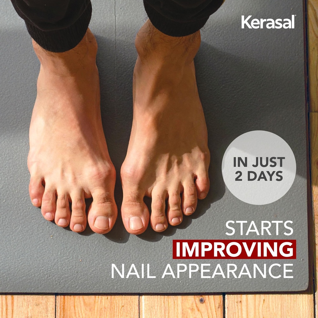 kerasal-nail-renewal-restores-appearance-2.jpg