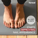 kerasal-nail-renewal-restores-appearance-2.jpg