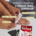 kerasal-nail-renewal-restores-appearance-3.jpg