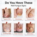 toenail-fungus-treatment-extra-strength--2.jpg