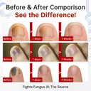 toenail-fungus-treatment-extra-strength--3.jpg