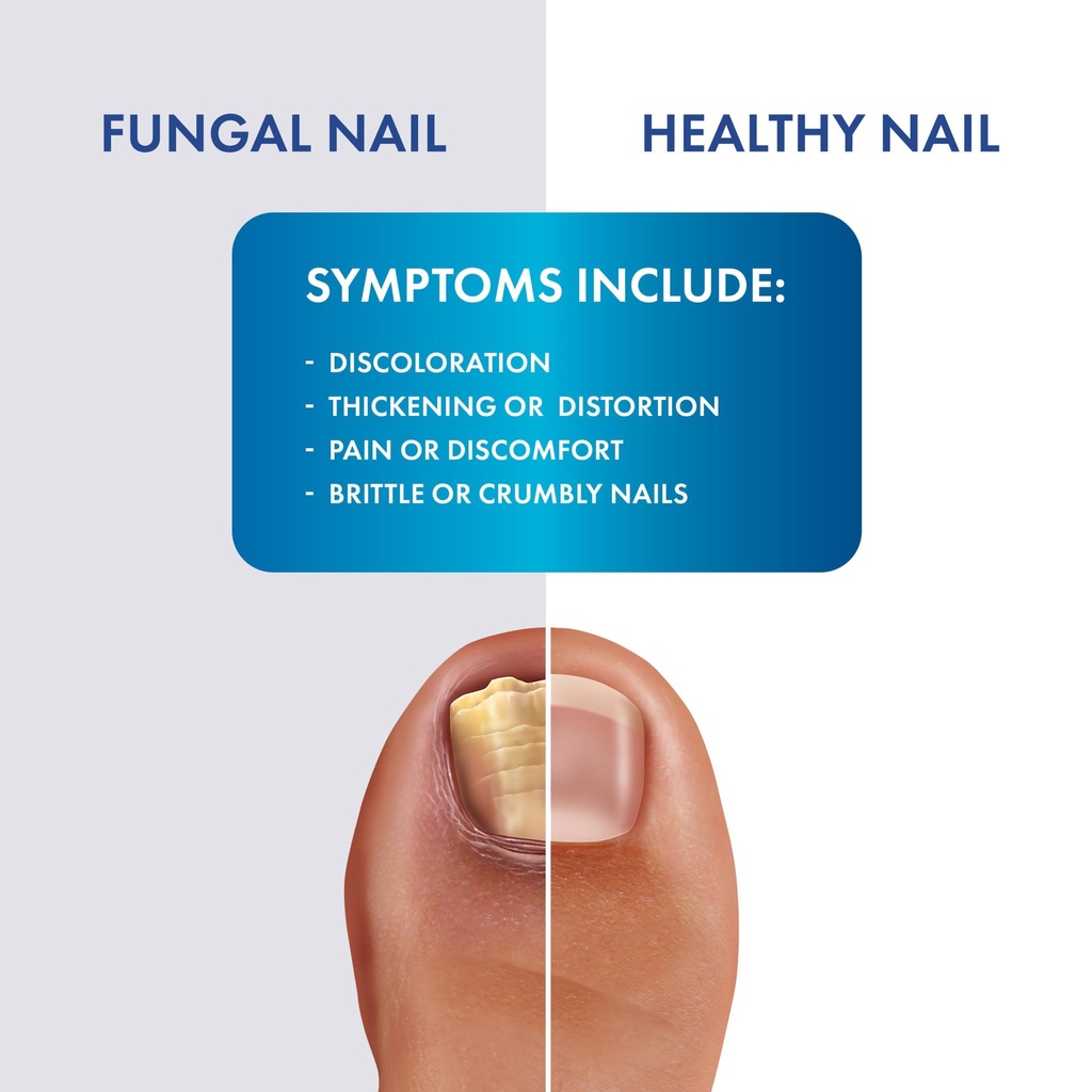 fungal-shield-max-strength-brush-on-anti-3.jpg