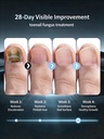 2026-upgrade-toenail-fungus-treatment-ma-4.jpg
