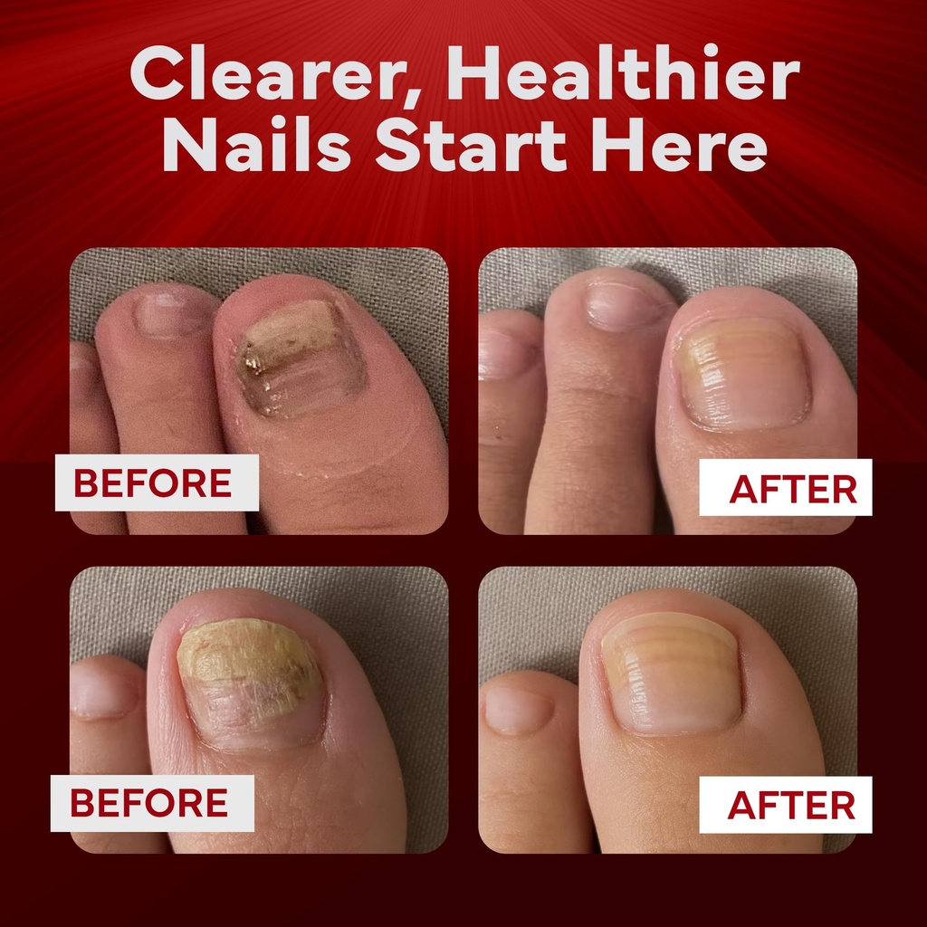 emuaidmax-nail-care-treatment-ointment-m-5.jpg