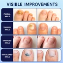 toenail-fungus-treatment-extra-strength--5.jpg