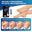 nail-fungus-treatment-pen-5-count-25-und-4.jpg