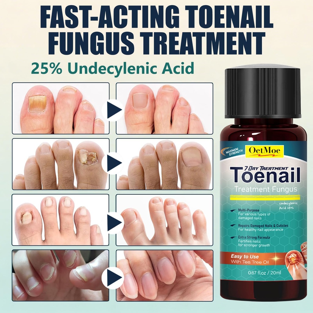 toenail-fungus-treatment-extra-strength--5.jpg