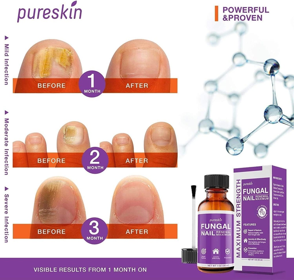 toenail-fungus-treatment-extra-strength--2.jpg