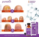 toenail-fungus-treatment-extra-strength--2.jpg