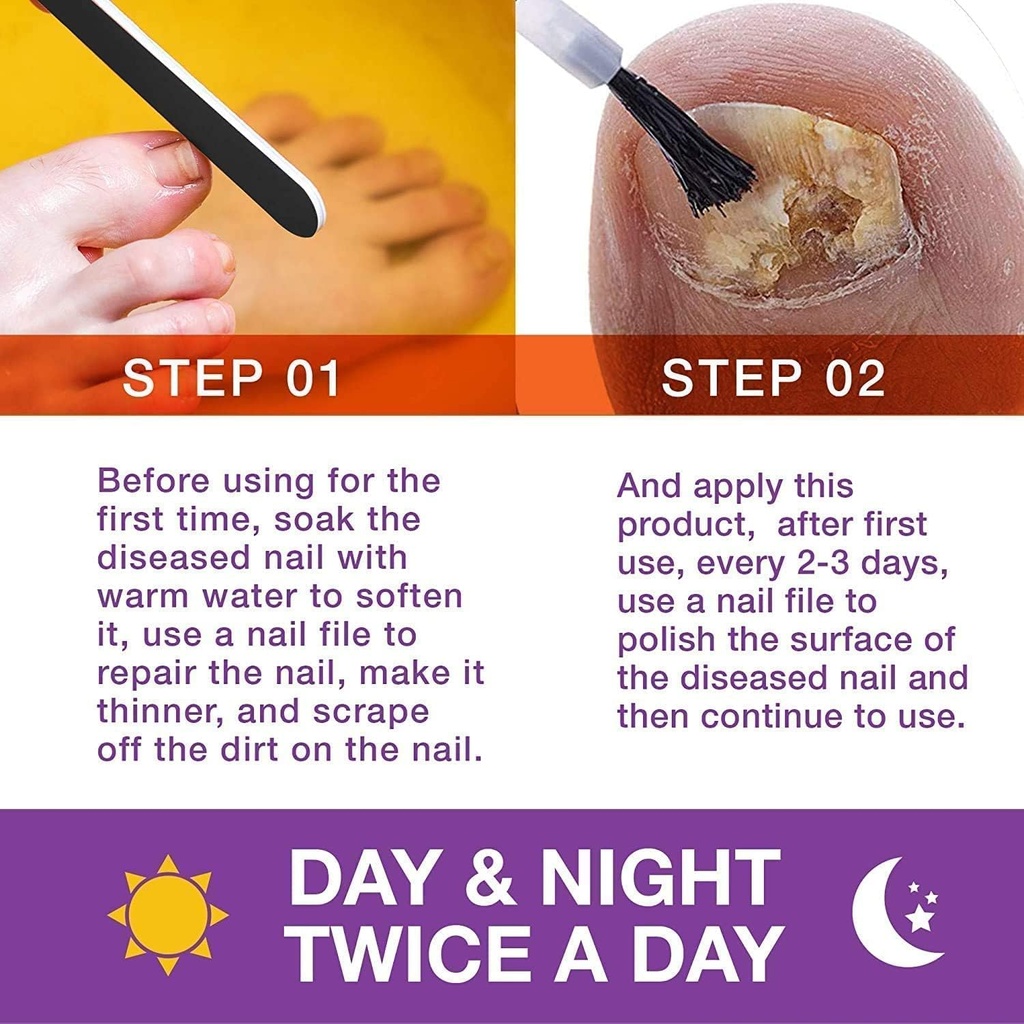 toenail-fungus-treatment-extra-strength--3.jpg