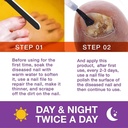 toenail-fungus-treatment-extra-strength--3.jpg