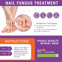 toenail-fungus-treatment-extra-strength--4.jpg