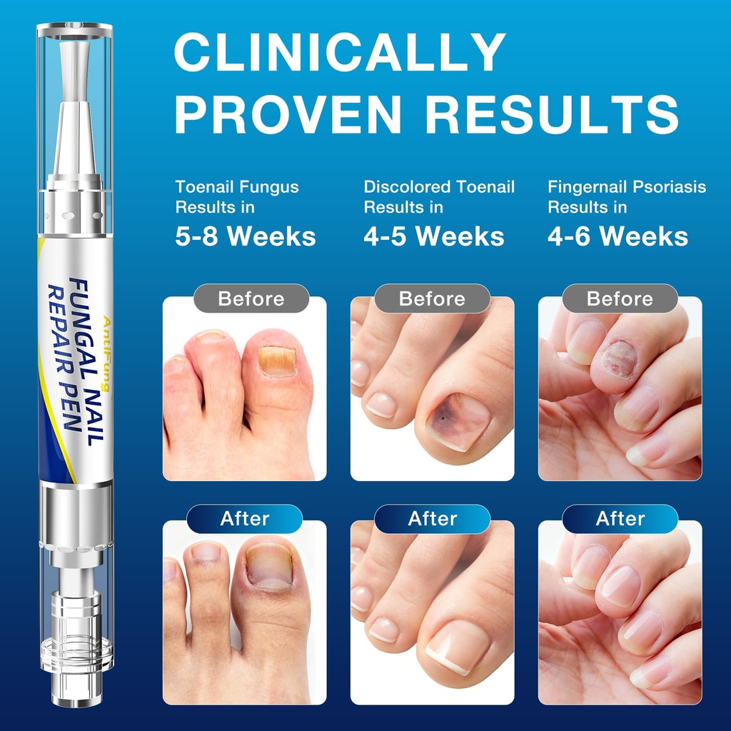 toenail-fungus-treatment-extra-strength--3.jpg