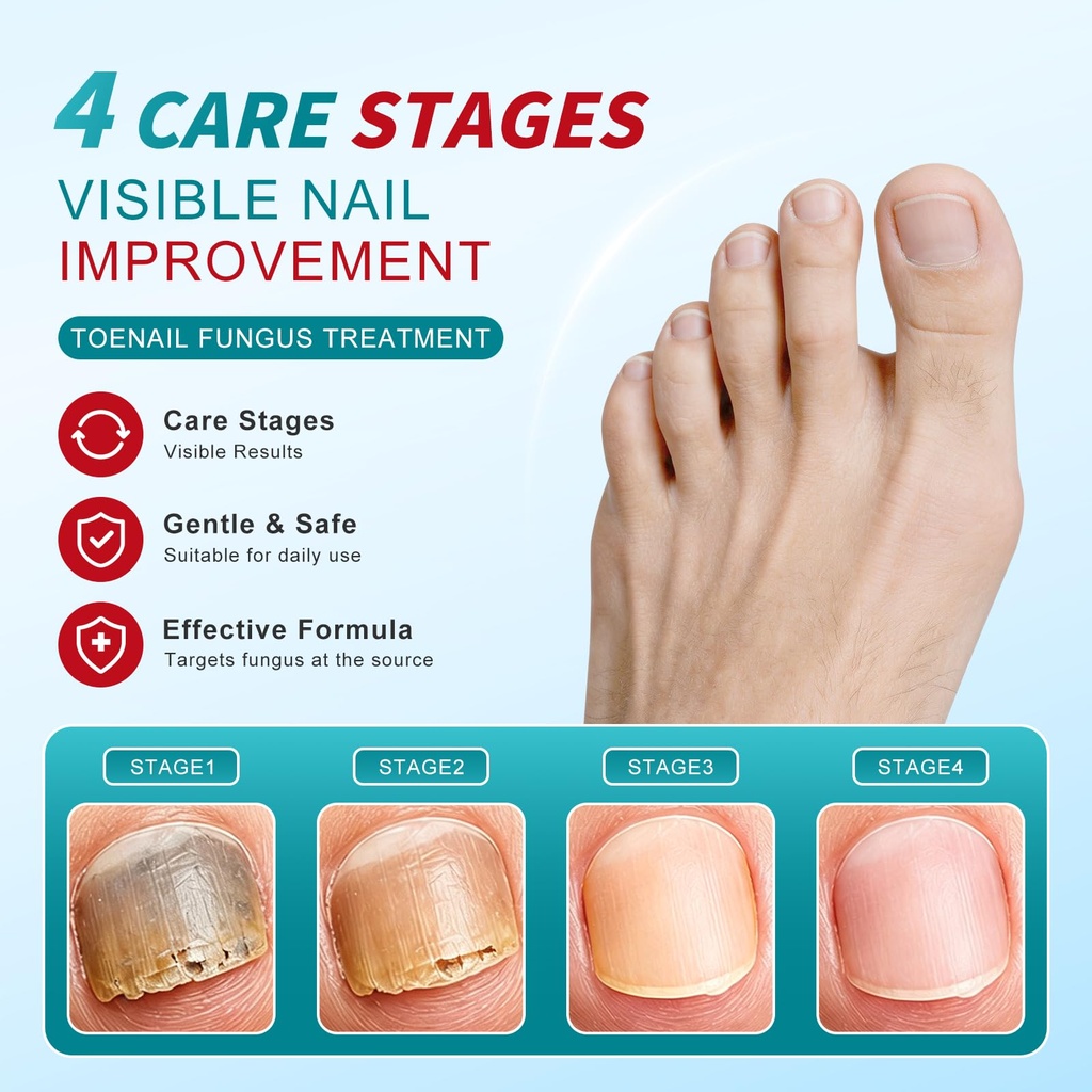 nail-fungus-pen-toenail-fungus-treatment-5.jpg