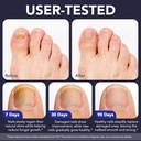 toenail-fungus-treatment-extra-strength--3.jpg