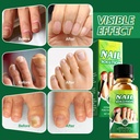toenail-fungus-treatment-extra-strength--5.jpg