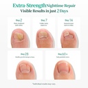 apuree-fungal-nail-patches-extra-strengt-4.jpg