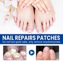 toenail-fungus-treatment-extra-strength--3.jpg