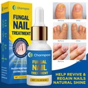 toenail-fungus-treatment-extra-strength--2.jpg