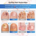 toenail-treatment-extra-strength-upgrade-5.jpg