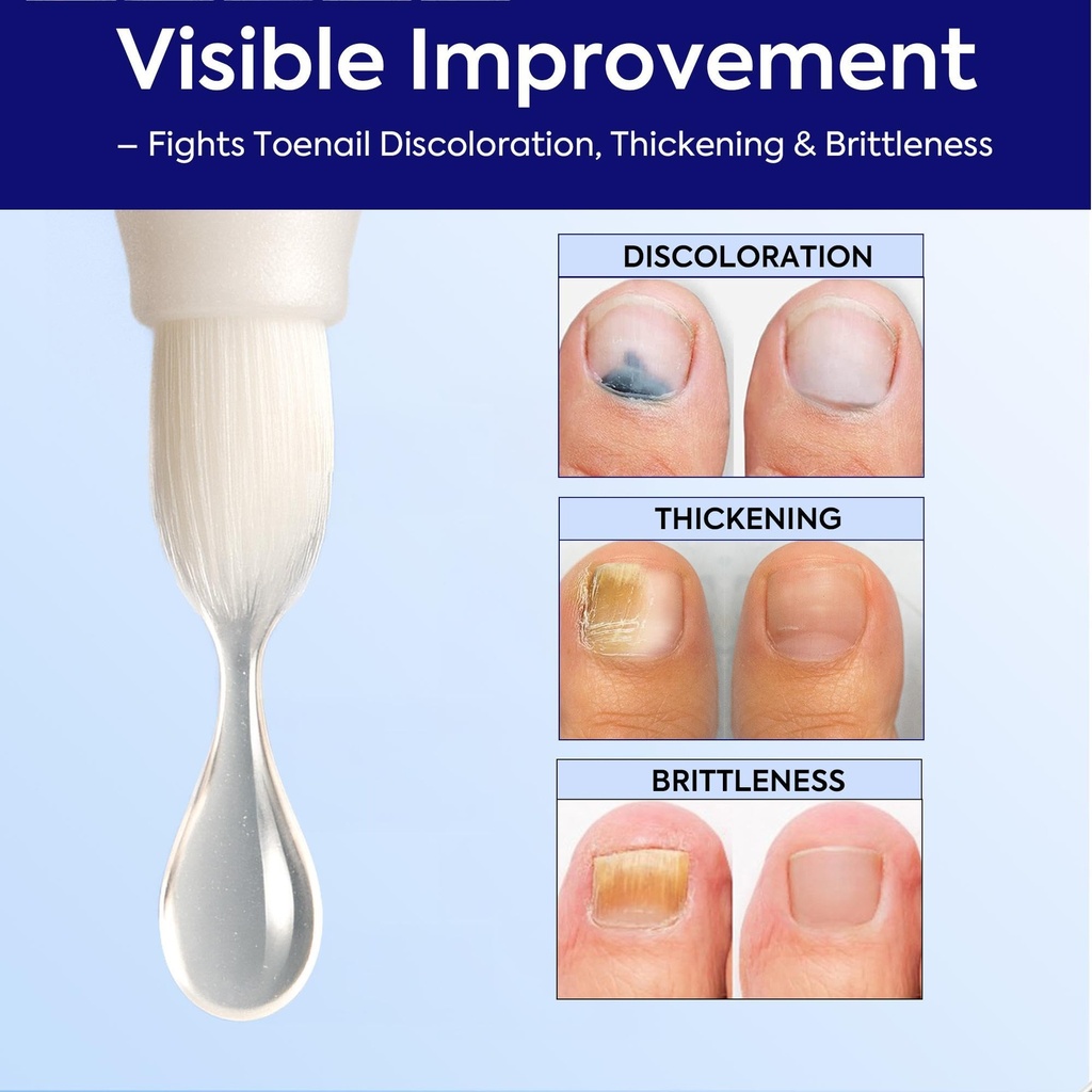 extra-strength-nail-care-solution-natura-2.jpg