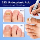 extra-strength-nail-care-solution-natura-3.jpg