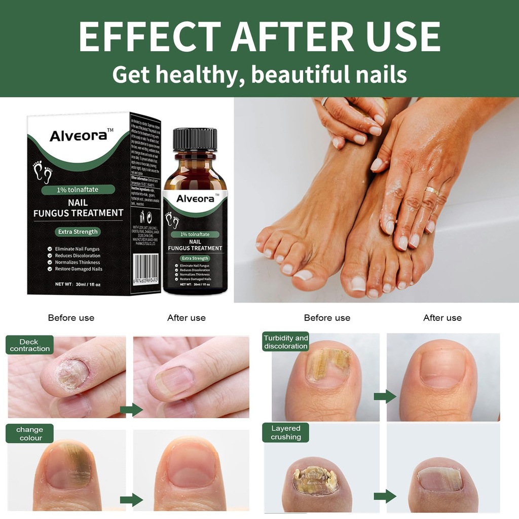 toenail-fungus-treatment-extra-strength--2.jpg