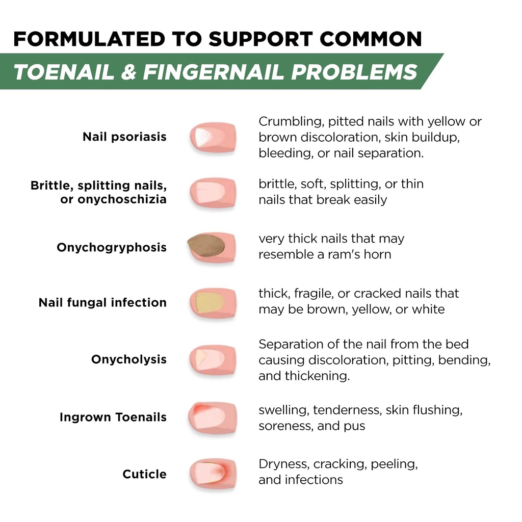 toenail-renewal-solution-extra-strength--4.jpg