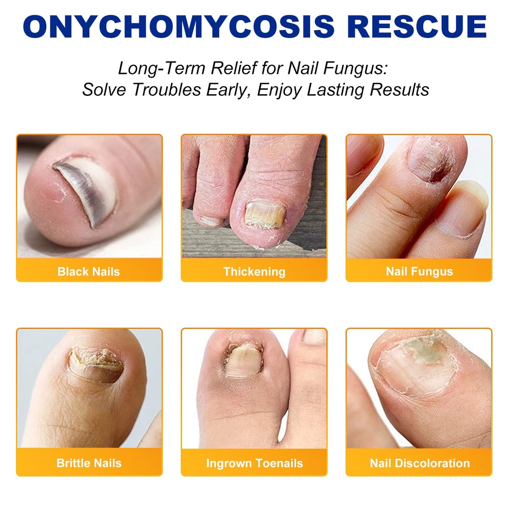 nail-patches-32-pcs-toenail-treatment-ex-6.jpg