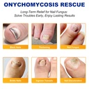 nail-patches-32-pcs-toenail-treatment-ex-6.jpg