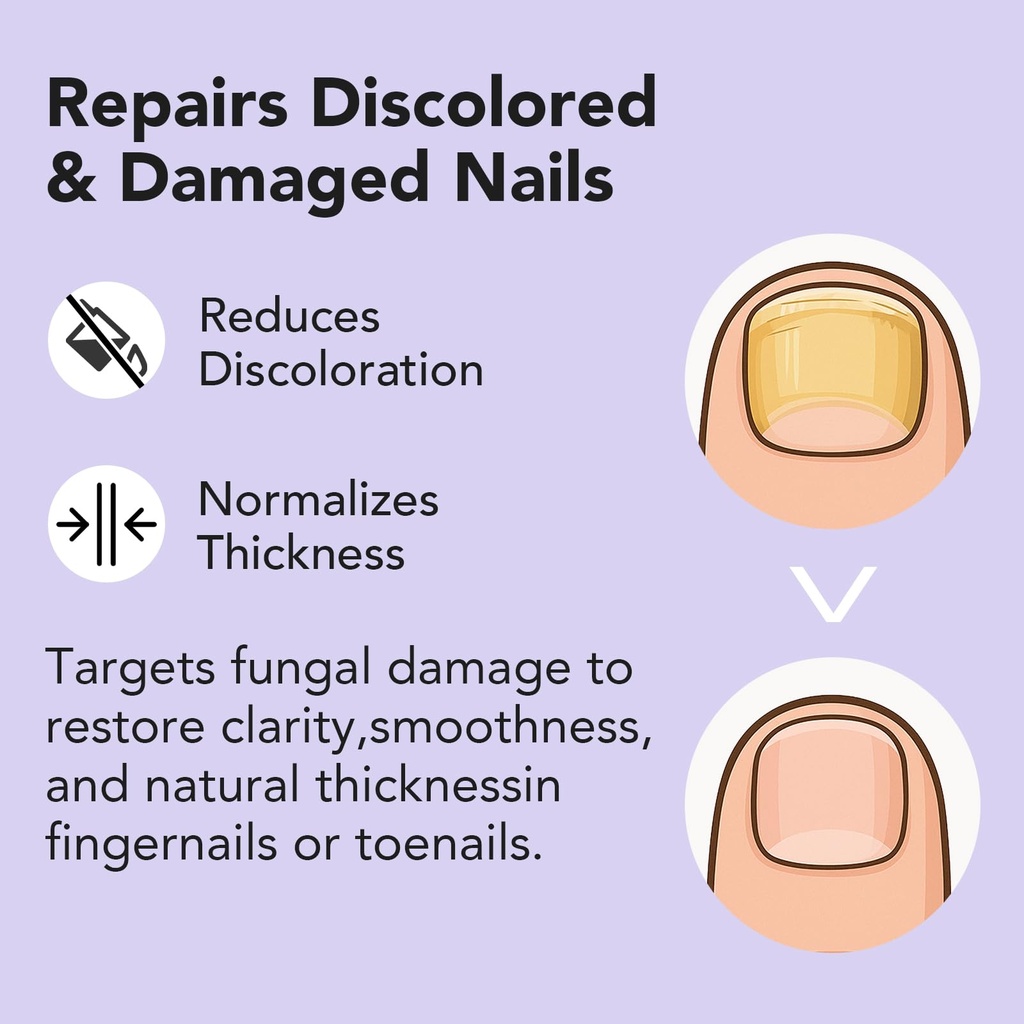 toenail-fungus-treatment-extra-strength--6.jpg