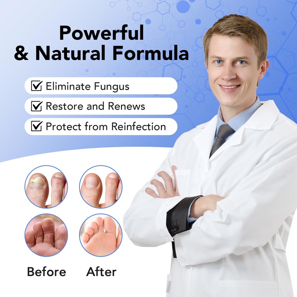 toenail-fungus-treatment-extra-strength--5.jpg
