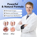 toenail-fungus-treatment-extra-strength--5.jpg