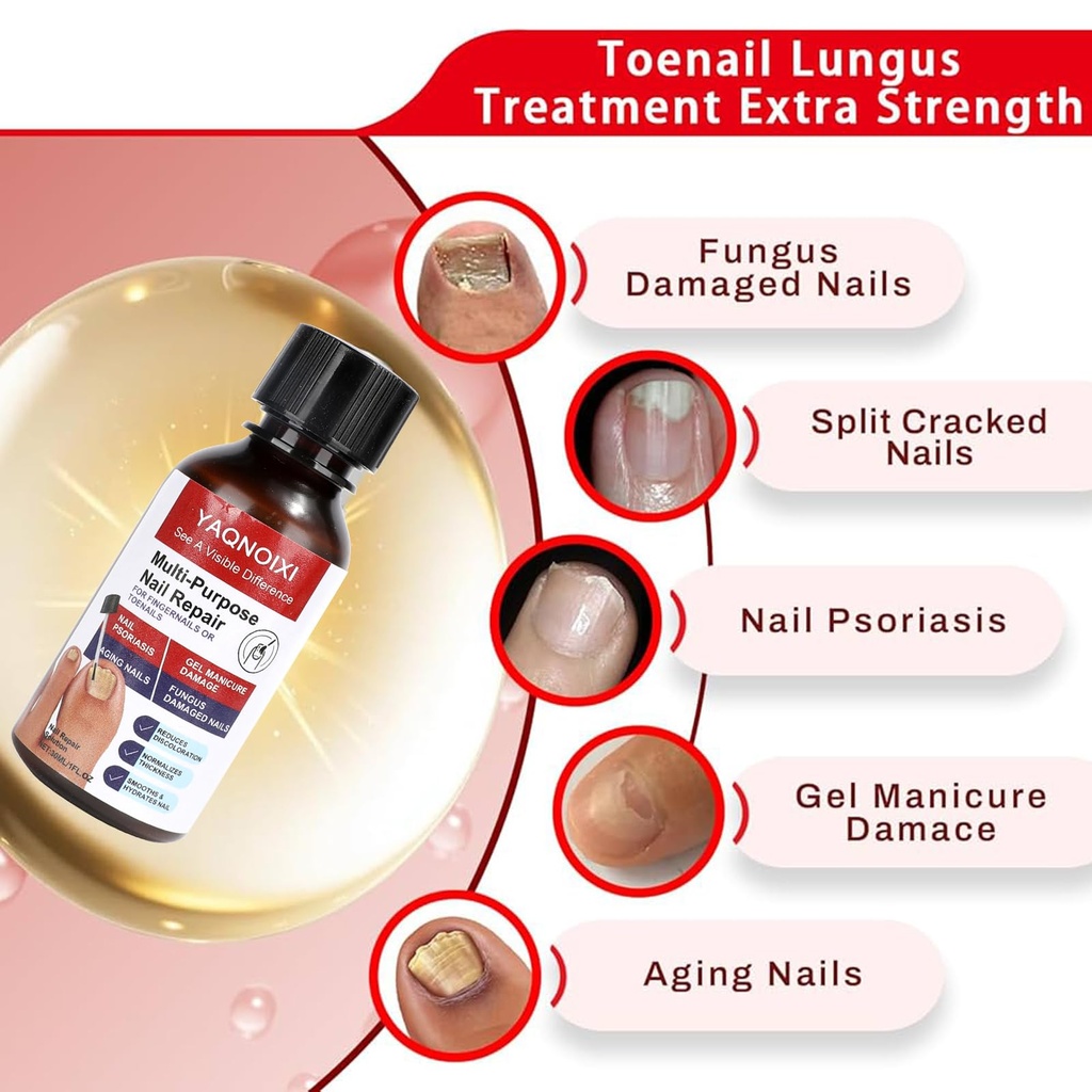 toenail-fungus-treatment-fast-acting-for-5.jpg