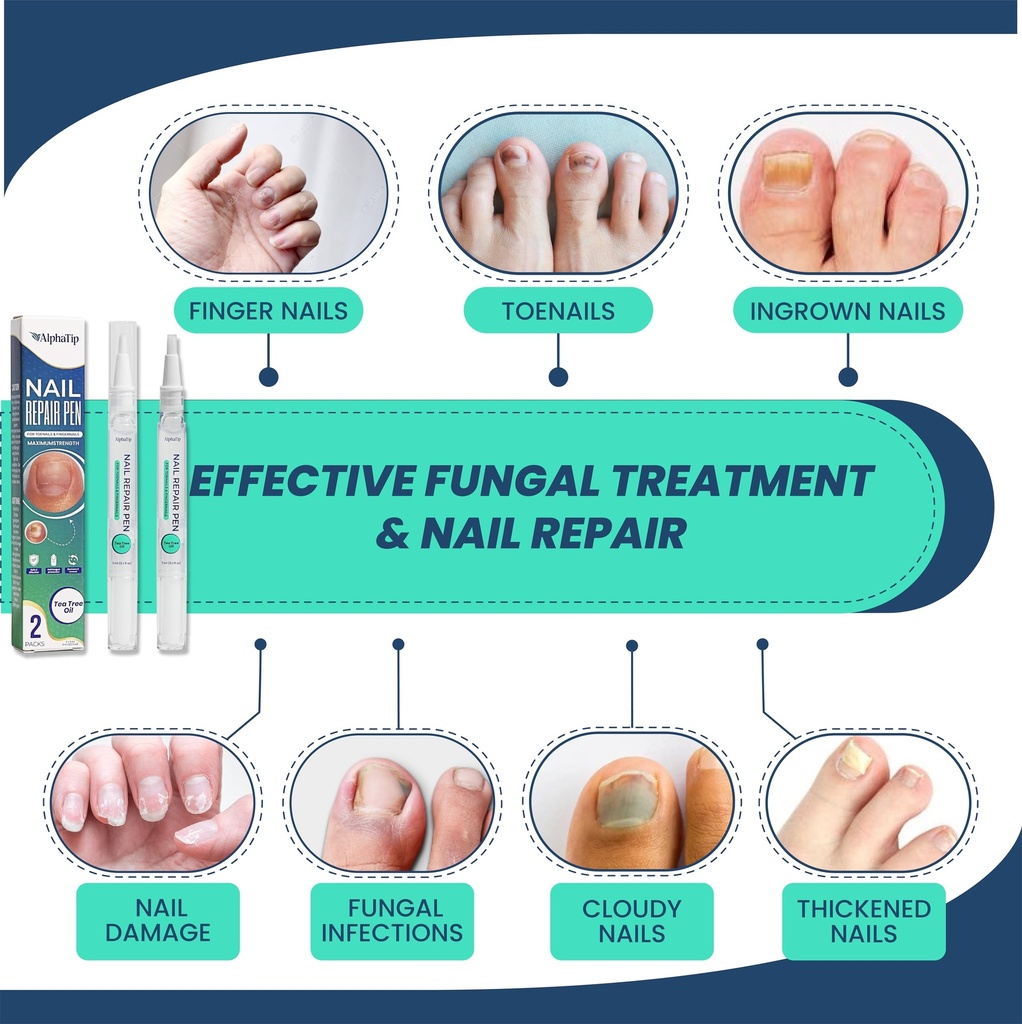 toenail-treatment-nail-repair-pen-nail-s-4.jpg