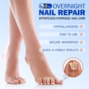 nail-patches-for-toenails-42pcs-hydrogel-5.jpg