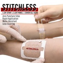 everlit-wound-closure-kit-surgical-zip-s-3.jpg