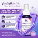 mediquick-hypochlorous-acid-spray-mist-t-2.jpg