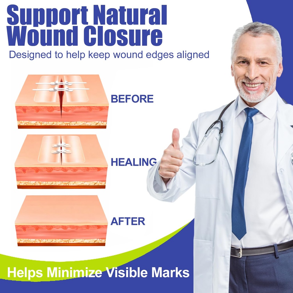 wound-closure-strips-for-skin-40-pack-st-4.jpg