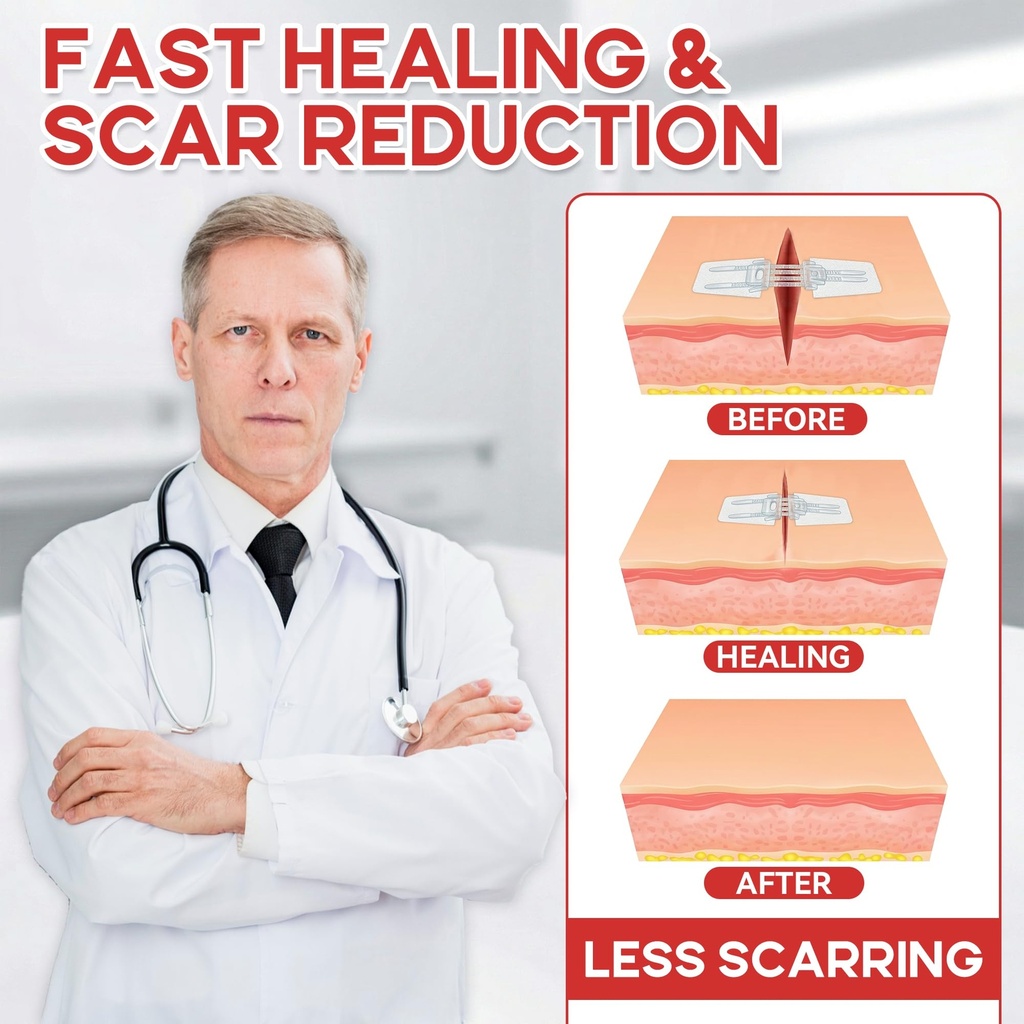 3-pcs-wound-closure-strips-for-emergency-5.jpg