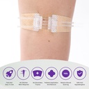 zip-stitch-13-pack-wound-closure-strip-3-6.jpg